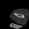 SPORK, NICO - 22.03.1976 - 02.08.2022 - CT obere Extremität - 17:51:17